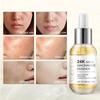 24k Gold Essence Gold Serum Tights Pores, Locks In Water And Moisturizes