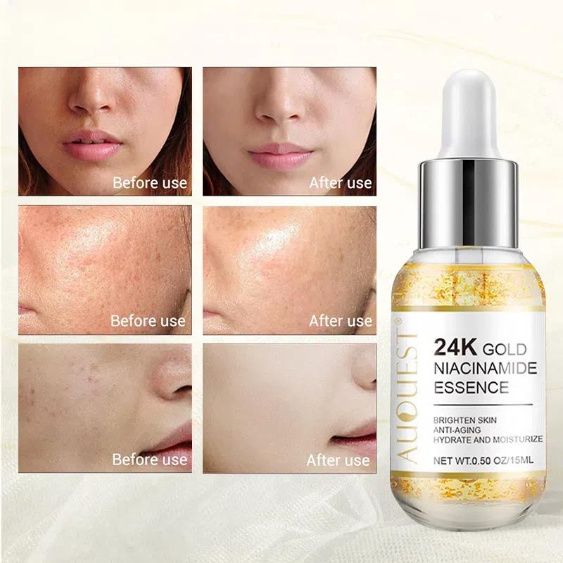 24k Gold Essence Gold Serum Tights Pores, Locks In Water And Moisturizes