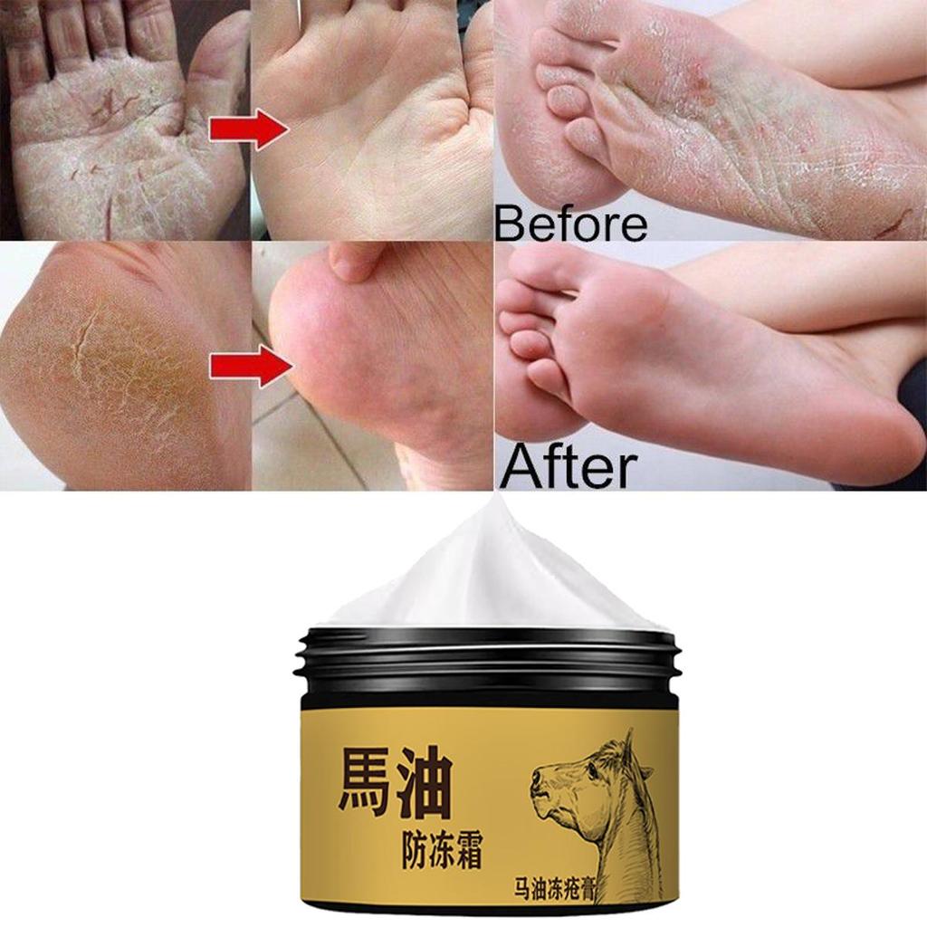 Horse Oil Antifreeze Cream, Hydrating and Moisturizing, Repairing Damaged, Dry and Cracked Skin, Caring for Skin with Horse Oil Frostbite Cream