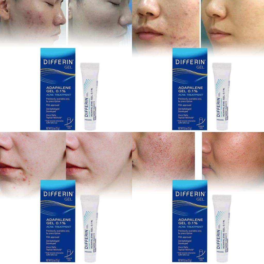 Differin Gel Traitement Acné Gel Rétinoïde Pour Peau Claire Radieuse 15g