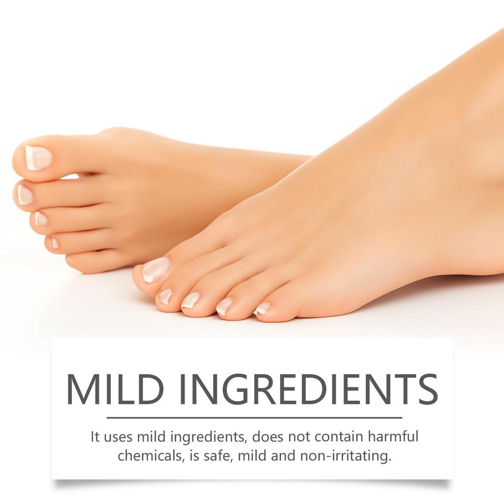 Nail Fungal Treatment Ointment Anti Infection Paronychia Onychomycosis Soft Hand Feet Toenail Repair Damaged Health Care Cream