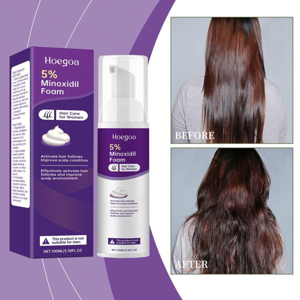 Hoegoa Minoxidil Schuim