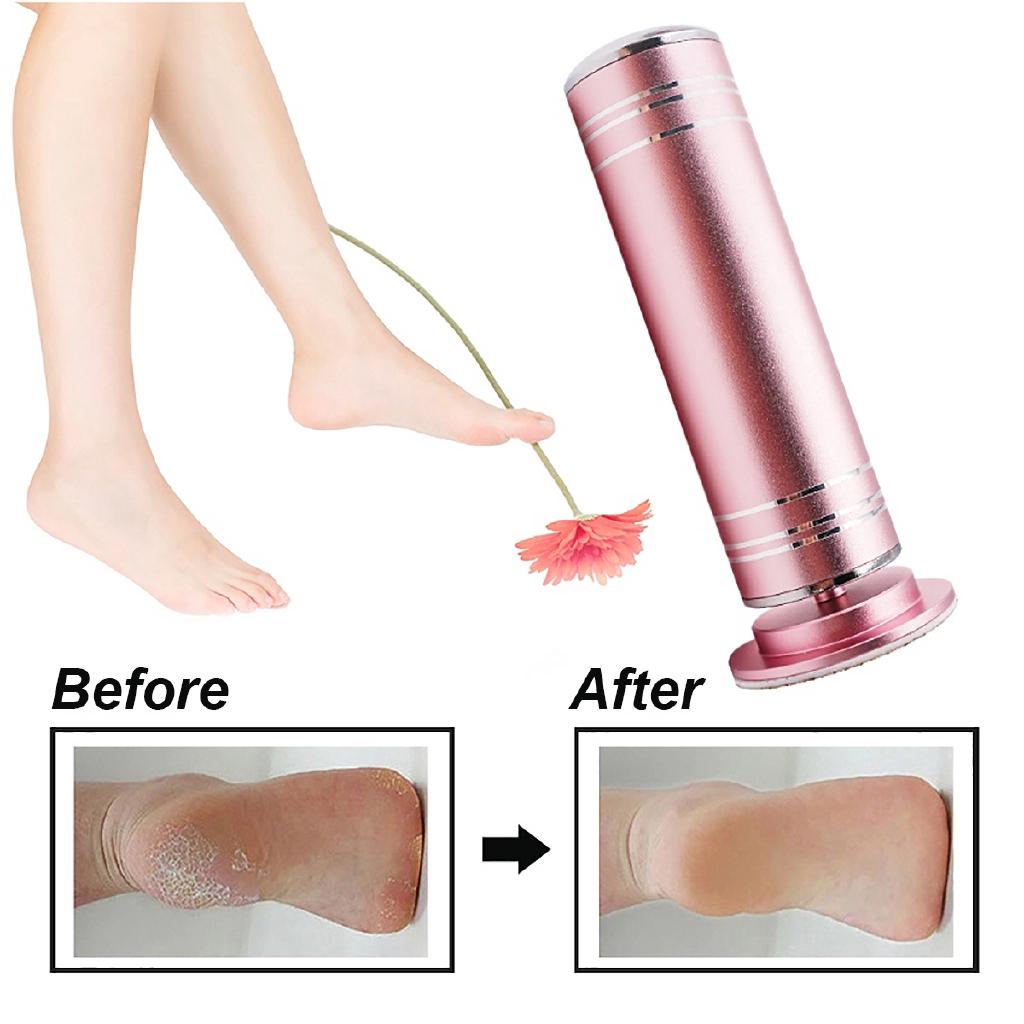 11.5x4.5cm 1000rpm Replacement Sandpaper Disks Remove Heel Dry Dead Skin Tools Electric Foot File Callus Remover Foot Care Tool with 60pcs