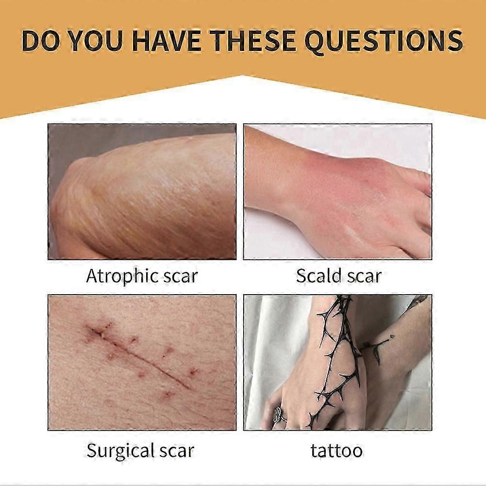 1-5x Unsichtbares Abdeckpflaster Haut-Tattoo Narbenabdeckung Wasserdicht Hautfarbenes Klebeband