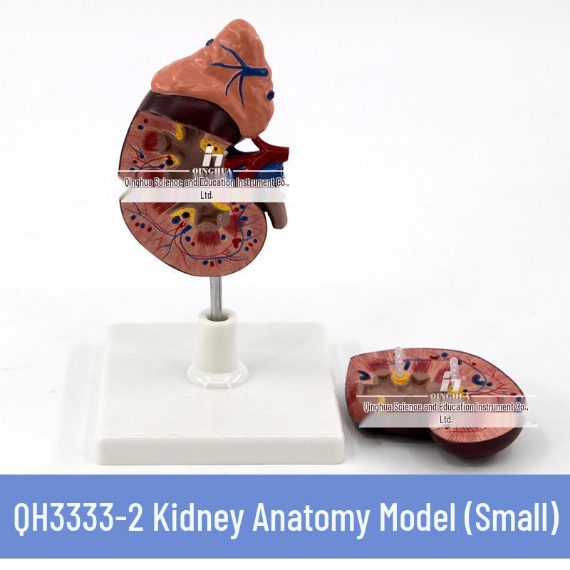 Magnified Human Kidney & Adrenal Gland Model with Diseased Kidney Anatomy