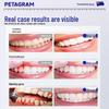 PETAGRAM Toothache Relief Spray
