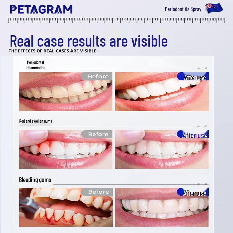 PETAGRAM Toothache Relief Spray