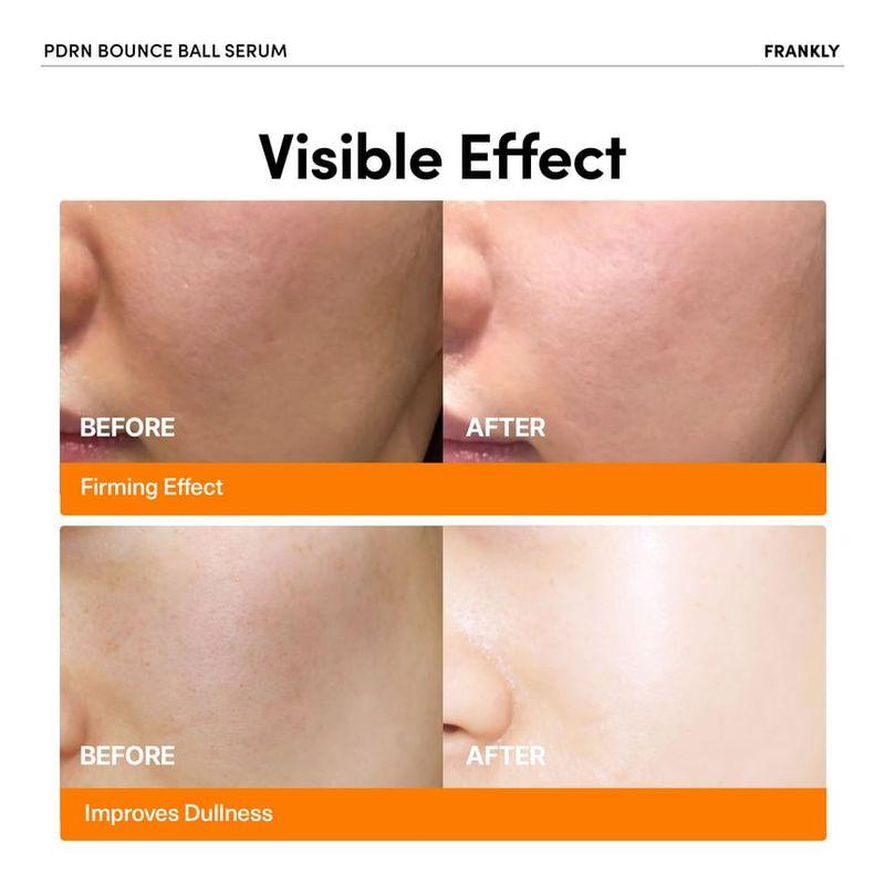 FRANKLY - PDRN Bounce Ball Serum