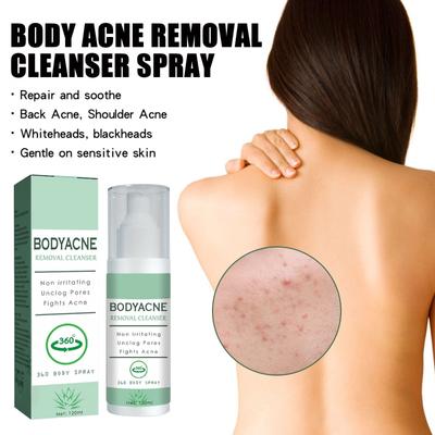 Back Acne Spray,Acne Relief Spray,Back Acne Serum,Body Moisturiser For Acne,Reduce Back Acne & Body Acne,Back Scrub Deep Cleansing,120ml