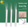 Stainless Steel Curved Comedone Extractor Tweezers for Blackhead and Pimple Removal
