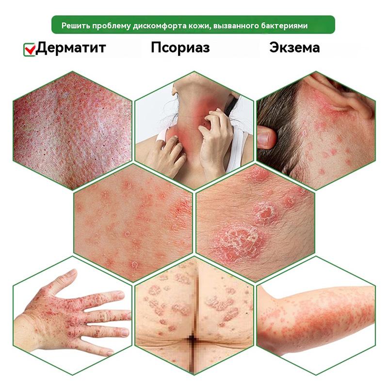 Caoshifu Natural Herbs Creams for Itch Solve Skin Problems 15g