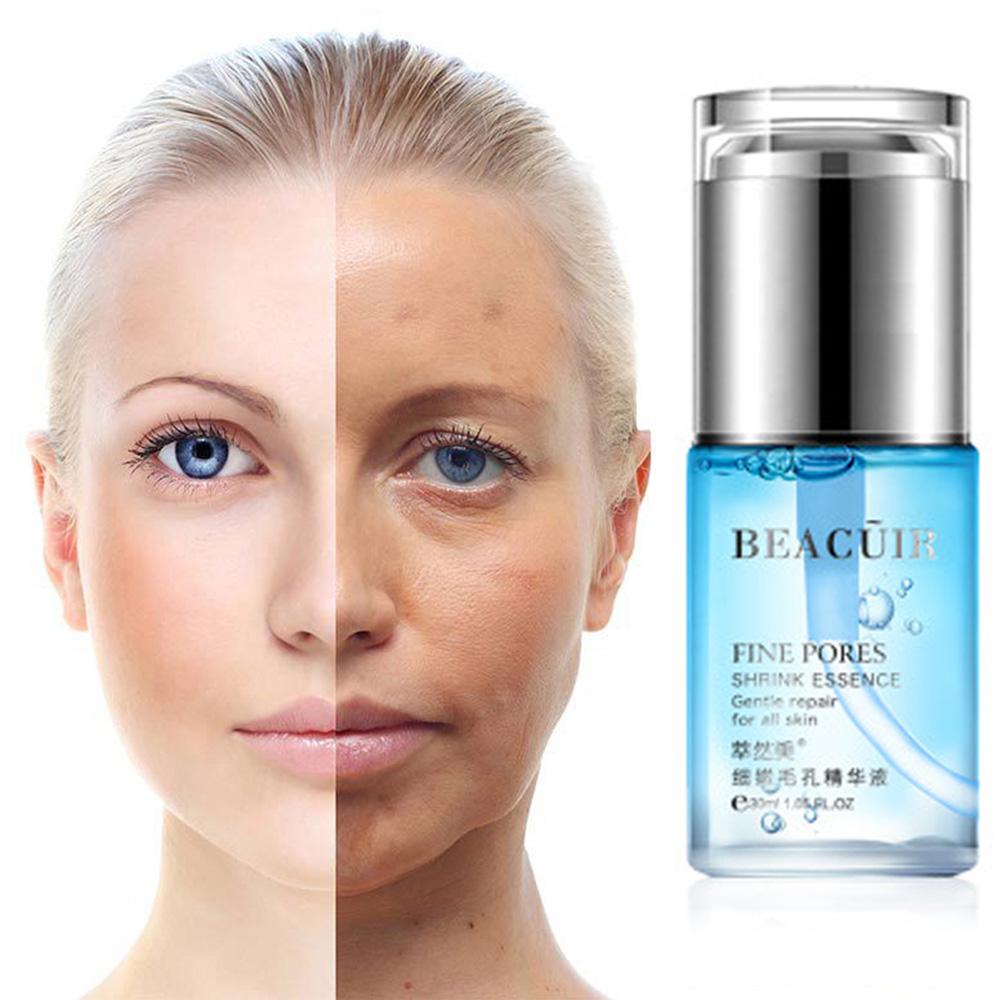 anti aging and acne skin care