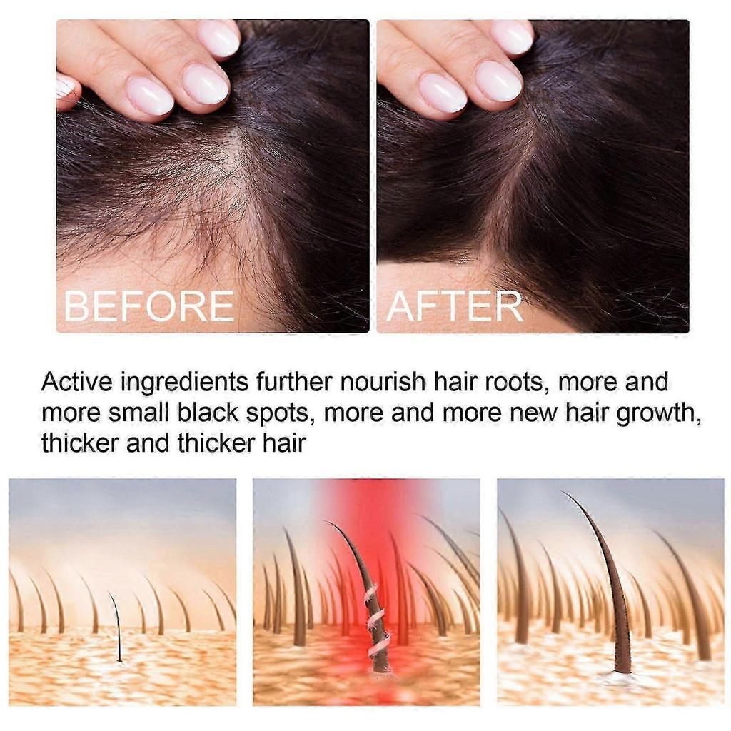 Ginger Hair Growth Spray for Thicker, Shinier Hair Moisturizing , Smoothing Essence with Ginger Root , Polygonum Multiflorum Promotes Hair Growth, D
