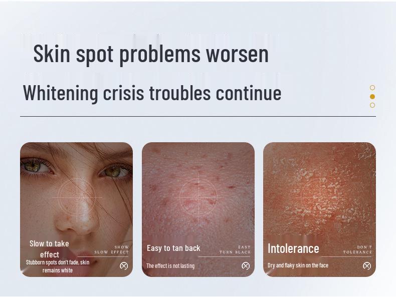 BiUi Whitening Repair Essence: Brightening & Rejuvenating Freckle Removal with Hydrating Niacinamide.