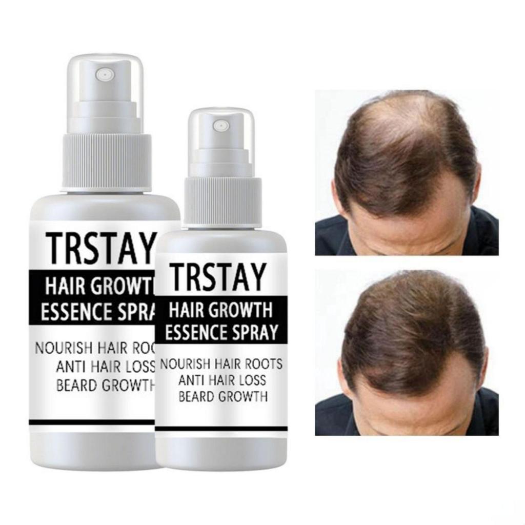 Orez fermentat FAST Ulei pentru creșterea părului Esență Uleiuri pentru păr Ser de creștere Ingrediente hrănitoare bogate