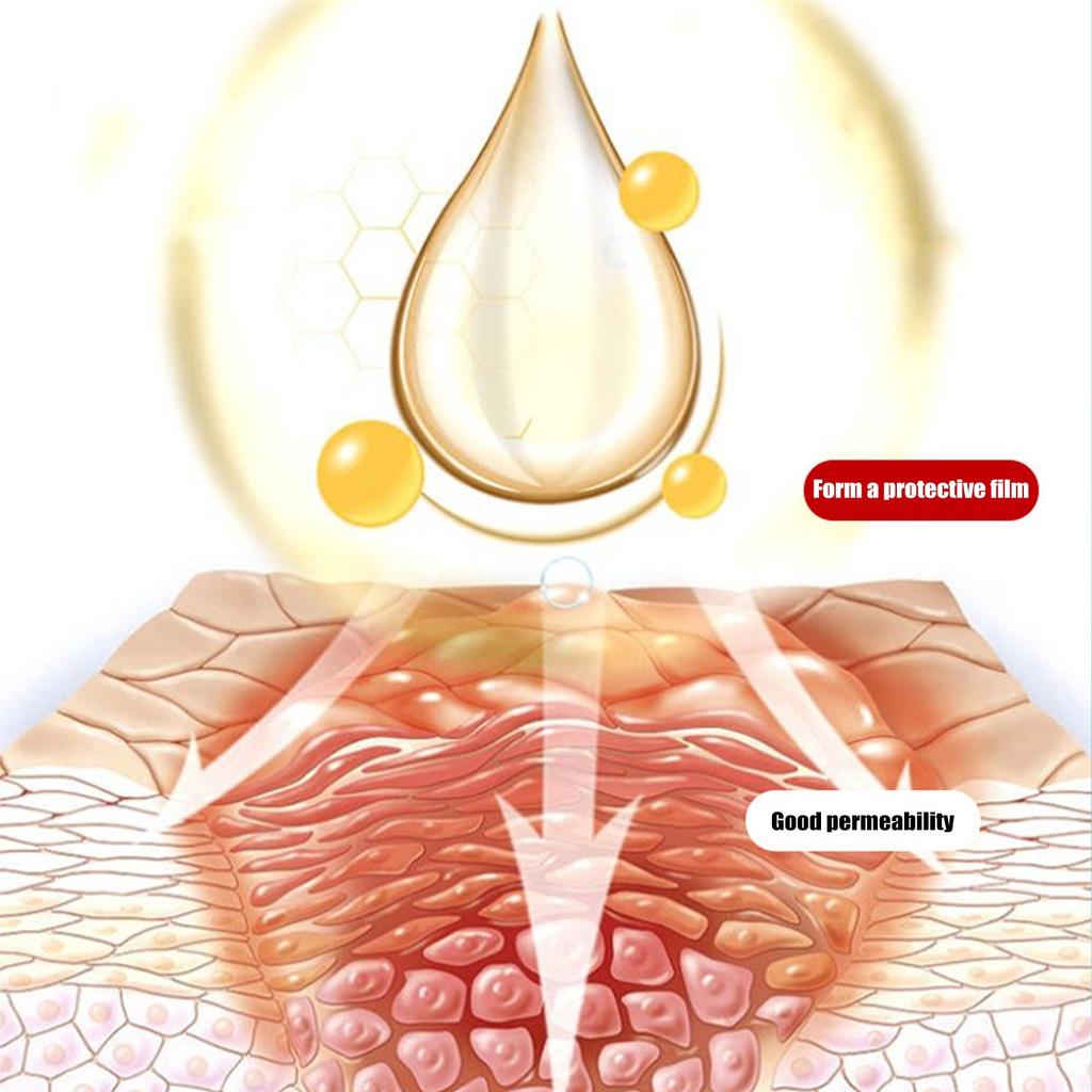 Tooth Stone Dissolving Spray Fresh Mouth Care Portable Mouth Spray 20ml