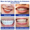 Dental Orthodontic Adhesive Kit Light Cure Glue Metal Ceramic Brackets Braces Invisible Bonding Dentistry Tools Dentist Material