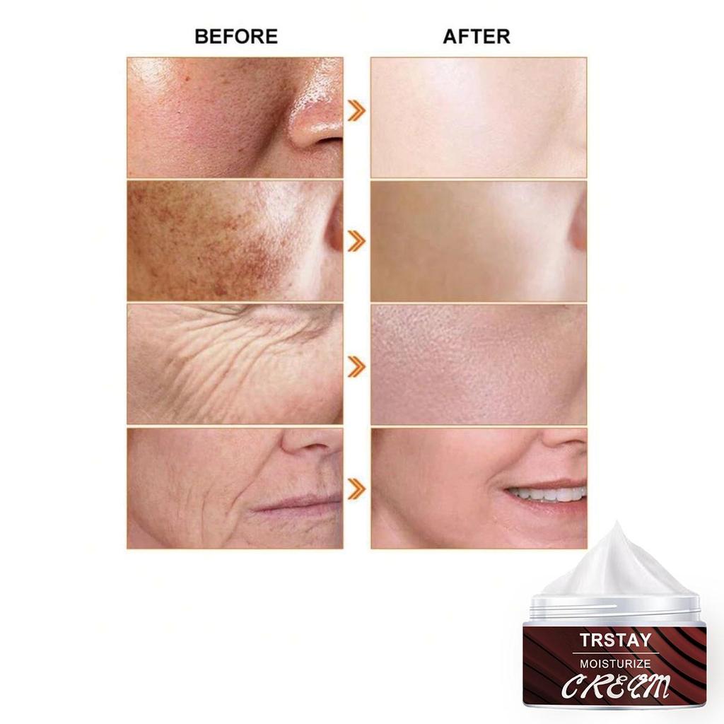 Face Whitening Essence Cream, Brighten and Repair Skin, Even Skin Color, Moisturizing and Moisturizing Cream