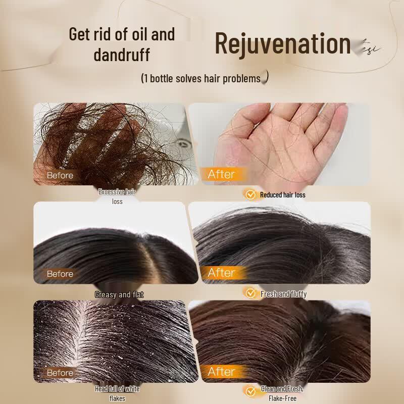 Vitress VTS Polygonum Multiflorum Hair Root Shampoo