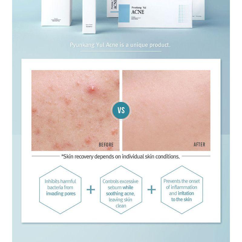 Pyunkang Yul Acne Cream 50ml