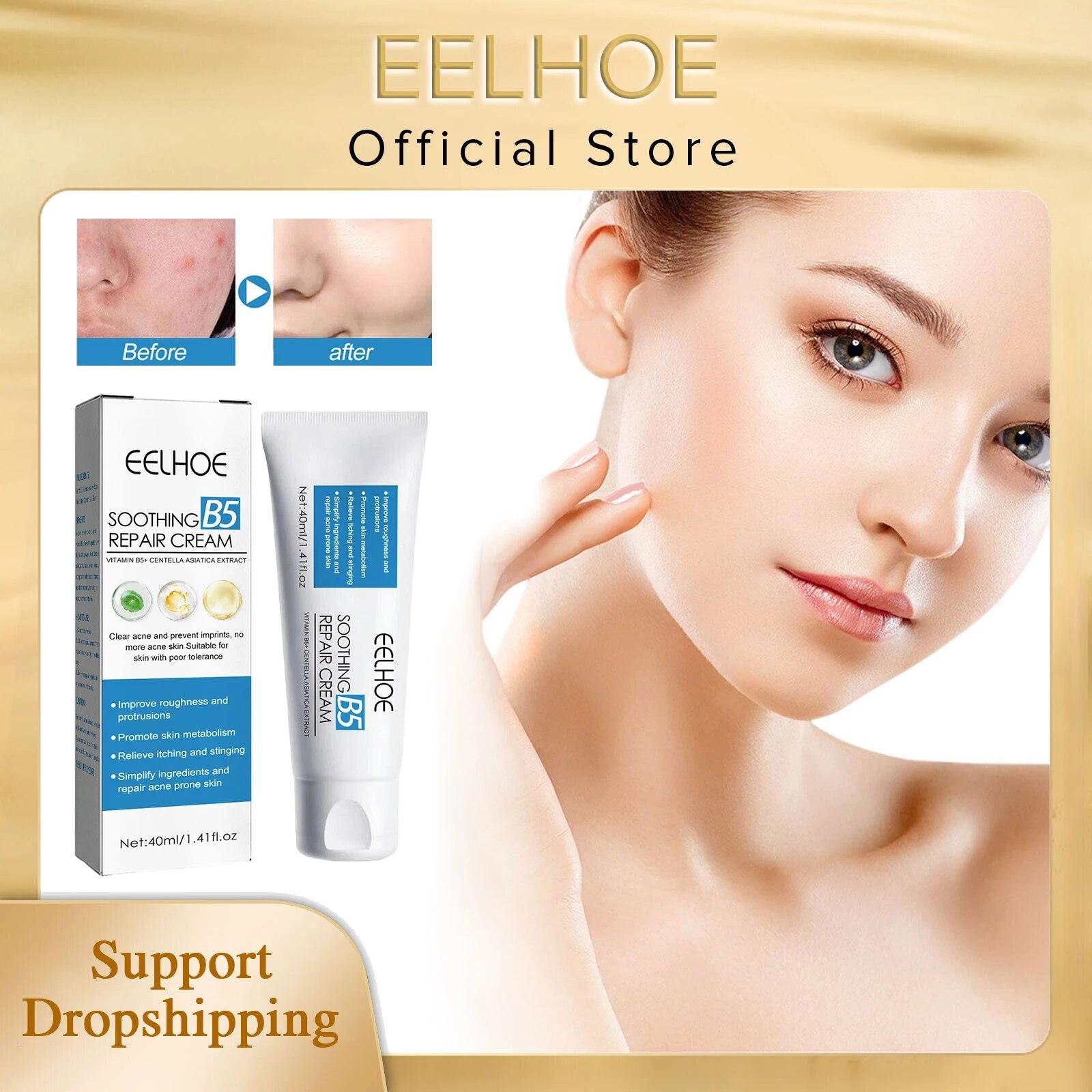 

EELHOE крем для удаления прыщей, осветляющий следы от прыщей, очищающий поры от прыщей, контроль масла, питательный увлажняющий крем для восстановления кожи