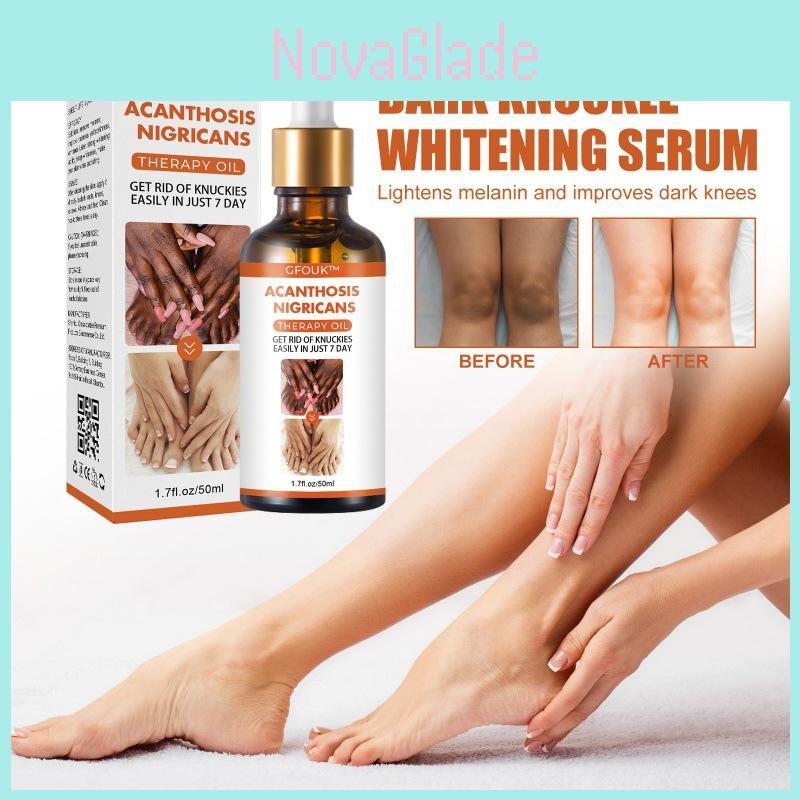 Nourishing Joint Beauty Essence For Radiant Skin Repairing Dark Knees And Ankles 50ml