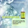 Niacinamid Serum - Verfärbungs Korrigierendes Serum - Aufhellendes Serum zur Bekämpfung von Dunklen Flecken und Hyperpigmentierung - Hautpflege für das Gesicht 30ML