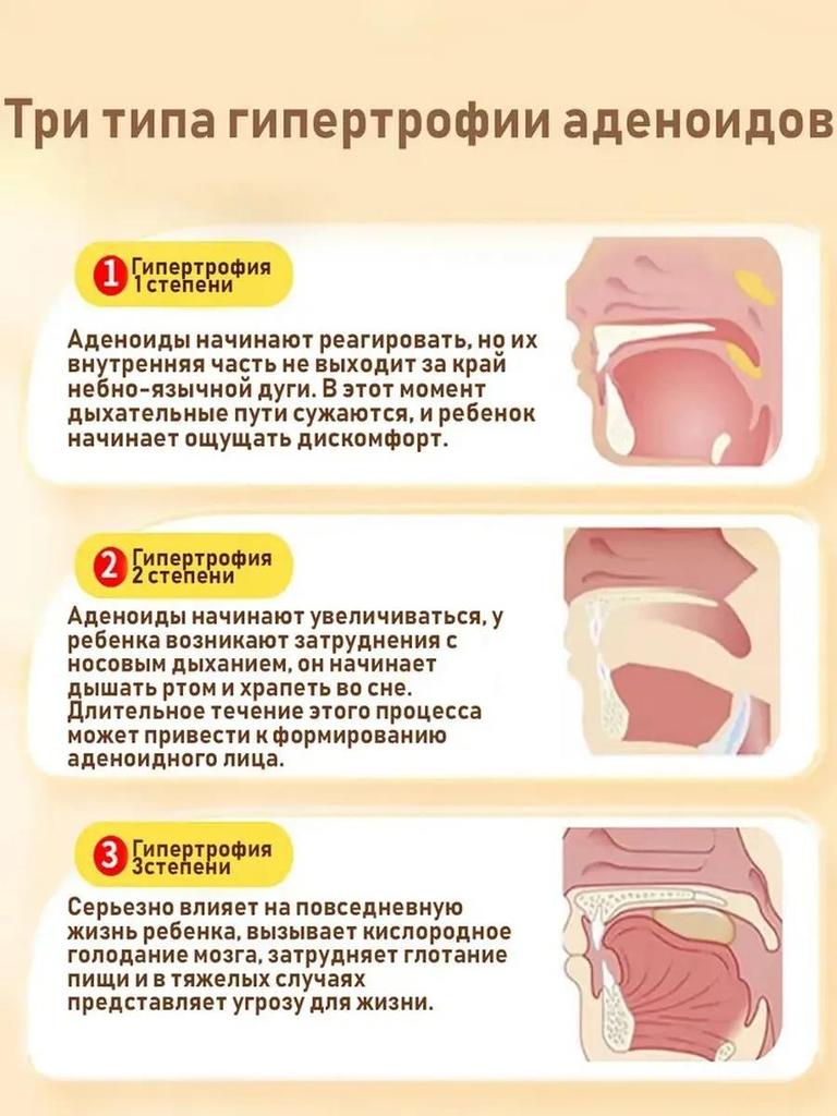 Adenoid Fat Rhinitis Nasal Congestion Sticker