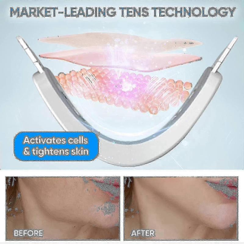 Electric V-face Shaping Beauty Belt, Double Chin Reducer Machine, Ems Face Lifting Machine JU