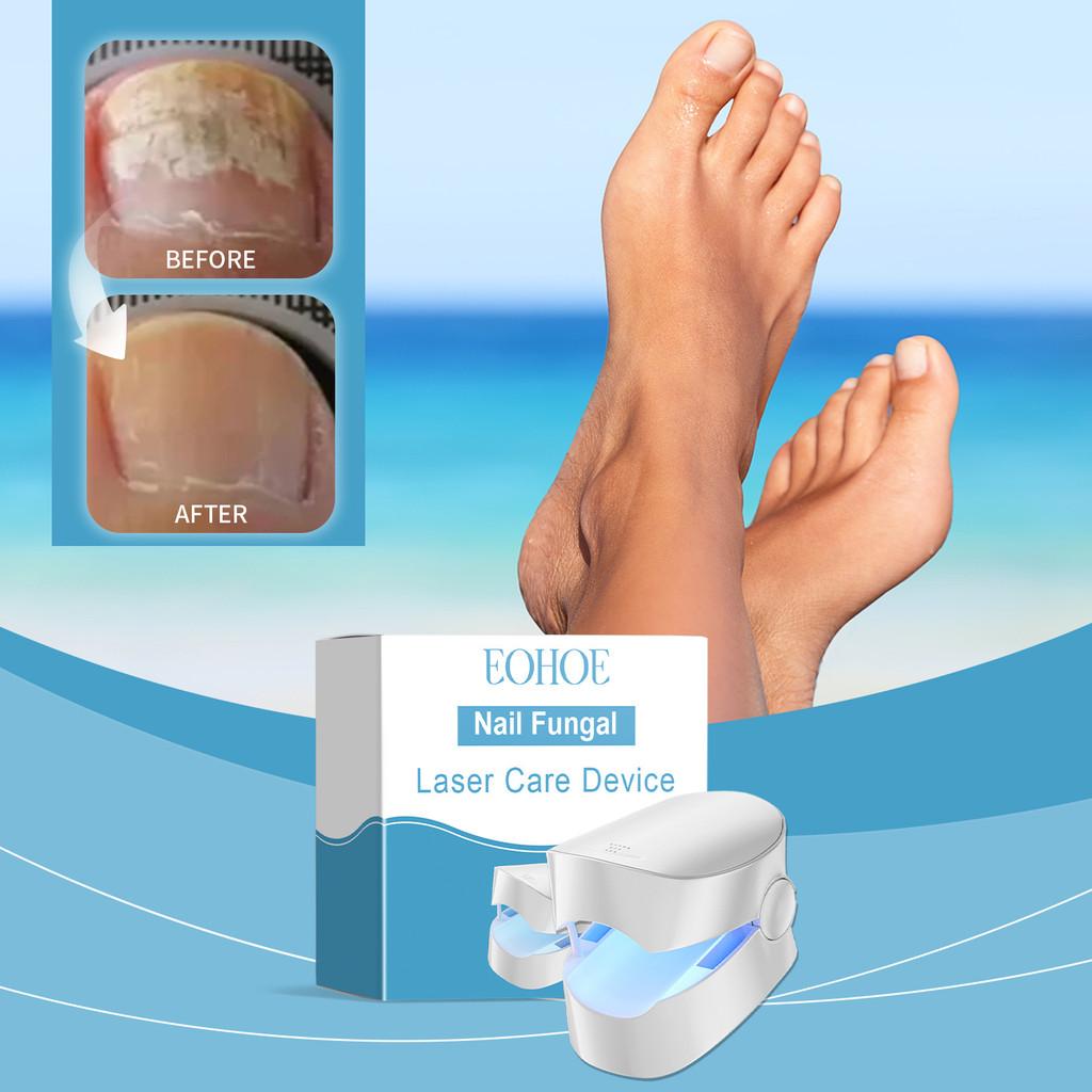 Eohoe Hand Nail Care Device For Gentle Nourishing Strengthening And Fortifying Nails