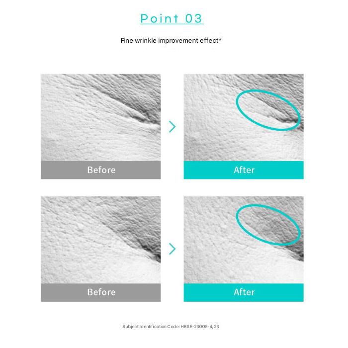 Rejuran Biome Healer Youth Formula Ampoule 30ml ,  Biome Healer Youth Formula Cream 50ml (7 Options)