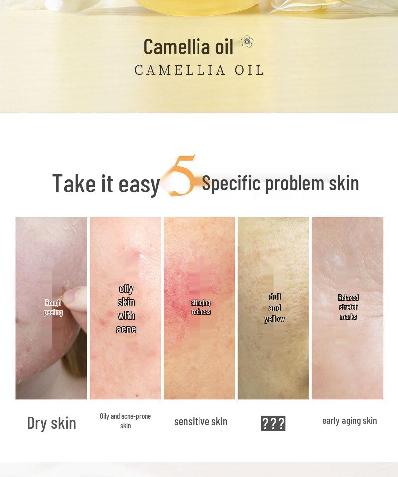 Xun Lifang Soothing Camellia Moisturizing Essence Oil - Hydrating & Nourishing Skin Care