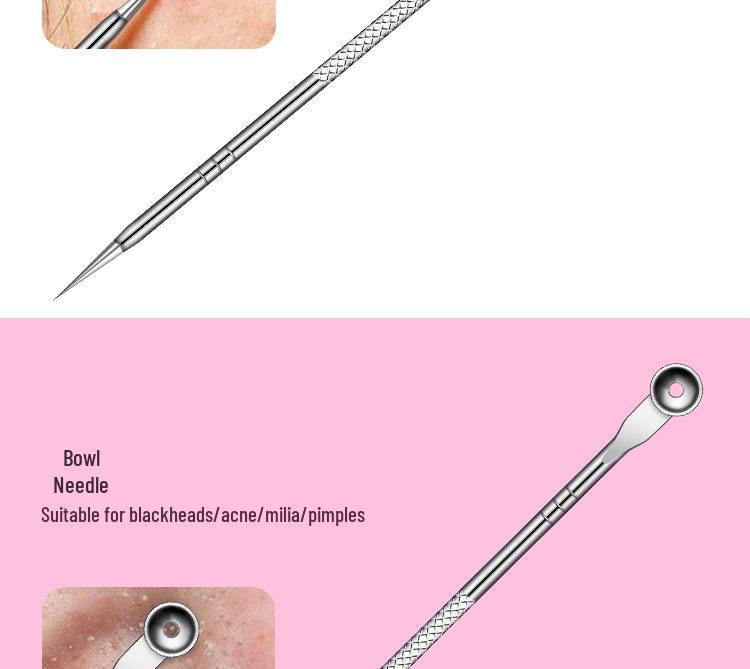10-Piece Stainless Steel Blackhead and Acne Remover Set