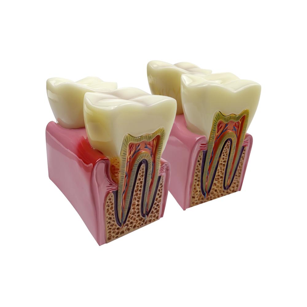 Big Dental Teeth Model Anatomy Large Dental Anatomical Model For Teaching Studying Education Demonstration Patient Communication