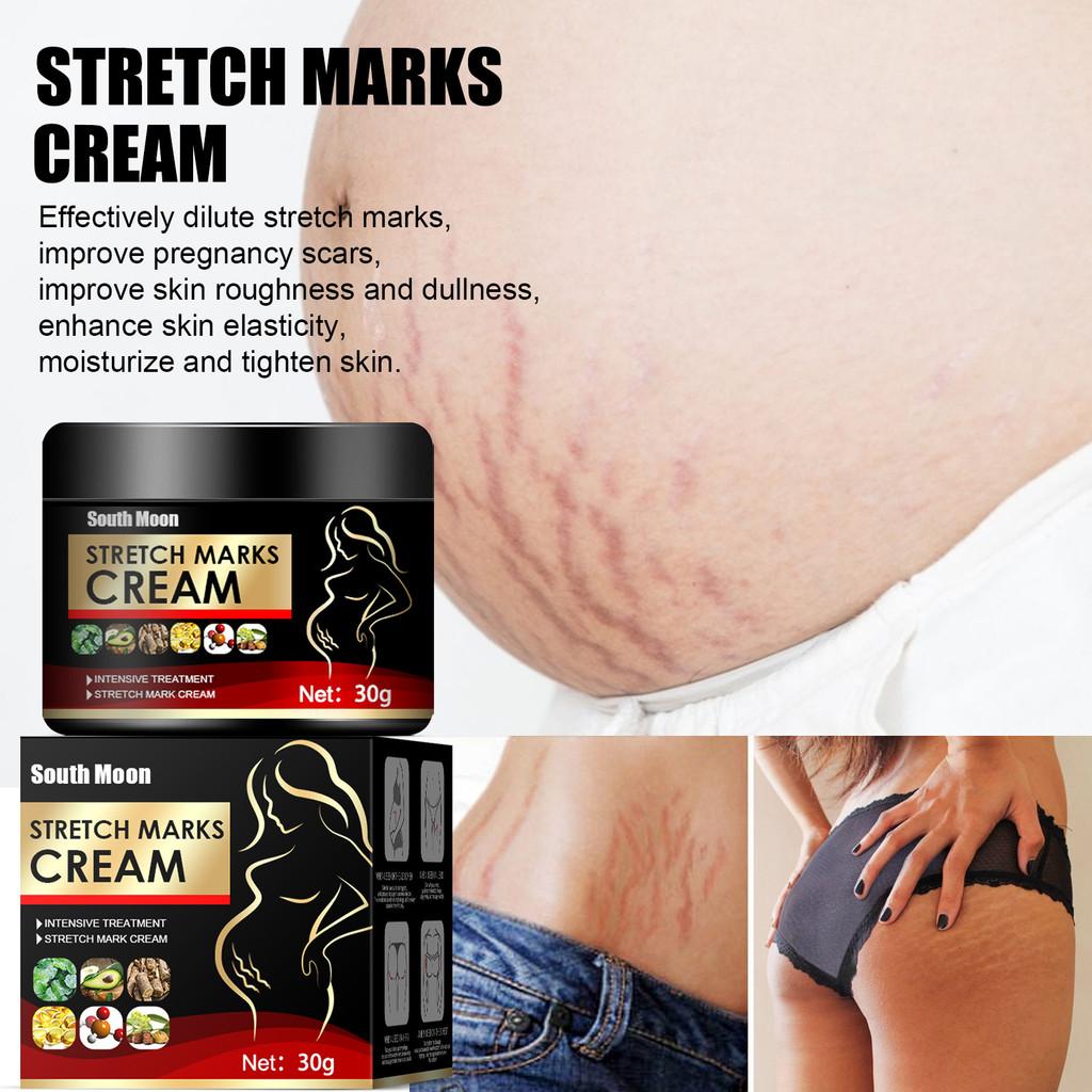 South Moon Scar Repair Cream Tightens Skin And Reduces Postpartum Scars