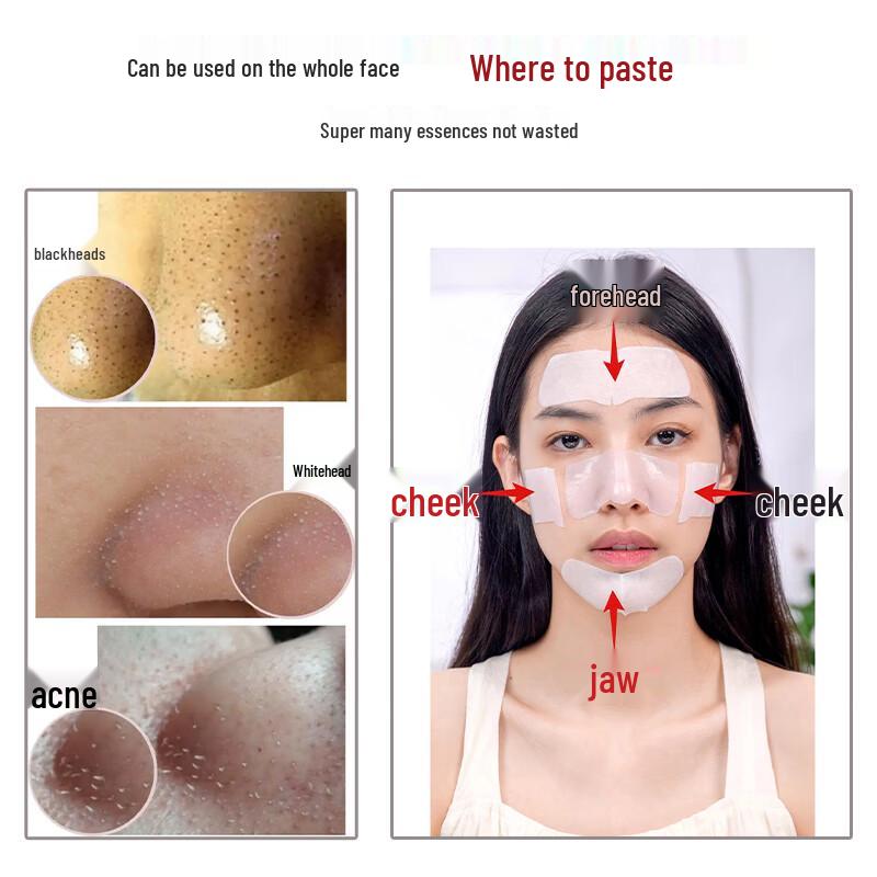 RNW Blackhead & Pore Cleansing Series