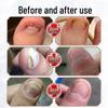 DR.JOINTNA Fungal Nail Treatment