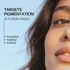 Advanced Spot Correcting Face Serum | Amber Microalgae, Glycolic Acid 2%, Niacinamide & Cica | Fades Dark Spots, Acne Marks & Pigmentation | All Sk