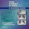 The Chest X-Ray: A Survival Guide Paperback