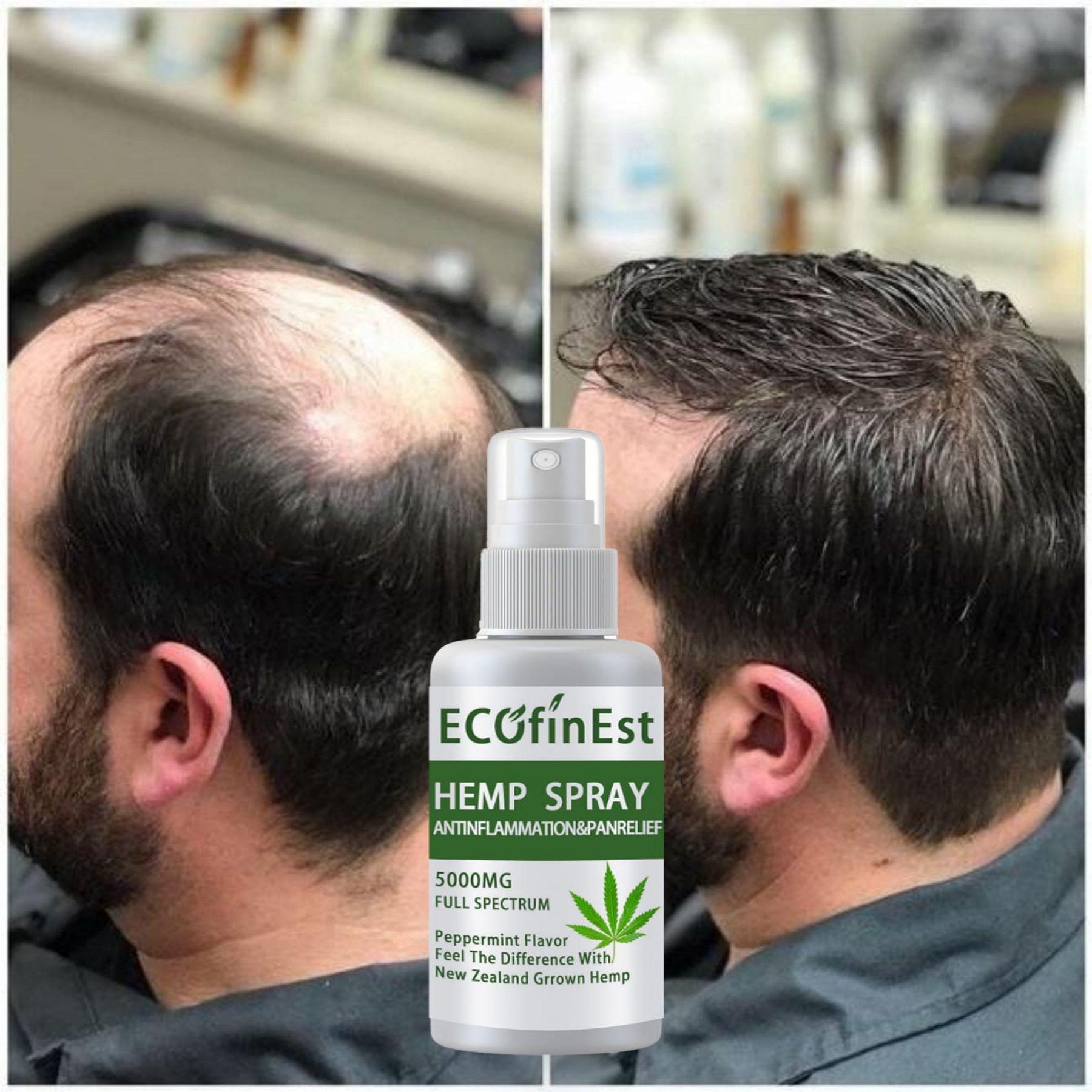 

Спрей для роста волос, эфирная сыворотка для роста волос, масло для роста бороды, уход за выпадением волос, красота, лечение линии волос головы для мужчин и женщин