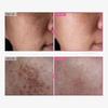 1-5x Arbutin 7% Tranexamic Acid 4% Cream 50ml Brightening K-beauty