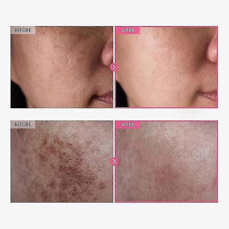 1-5x Arbutin 7% Tranexamic Acid 4% Cream 50ml Brightening K-beauty