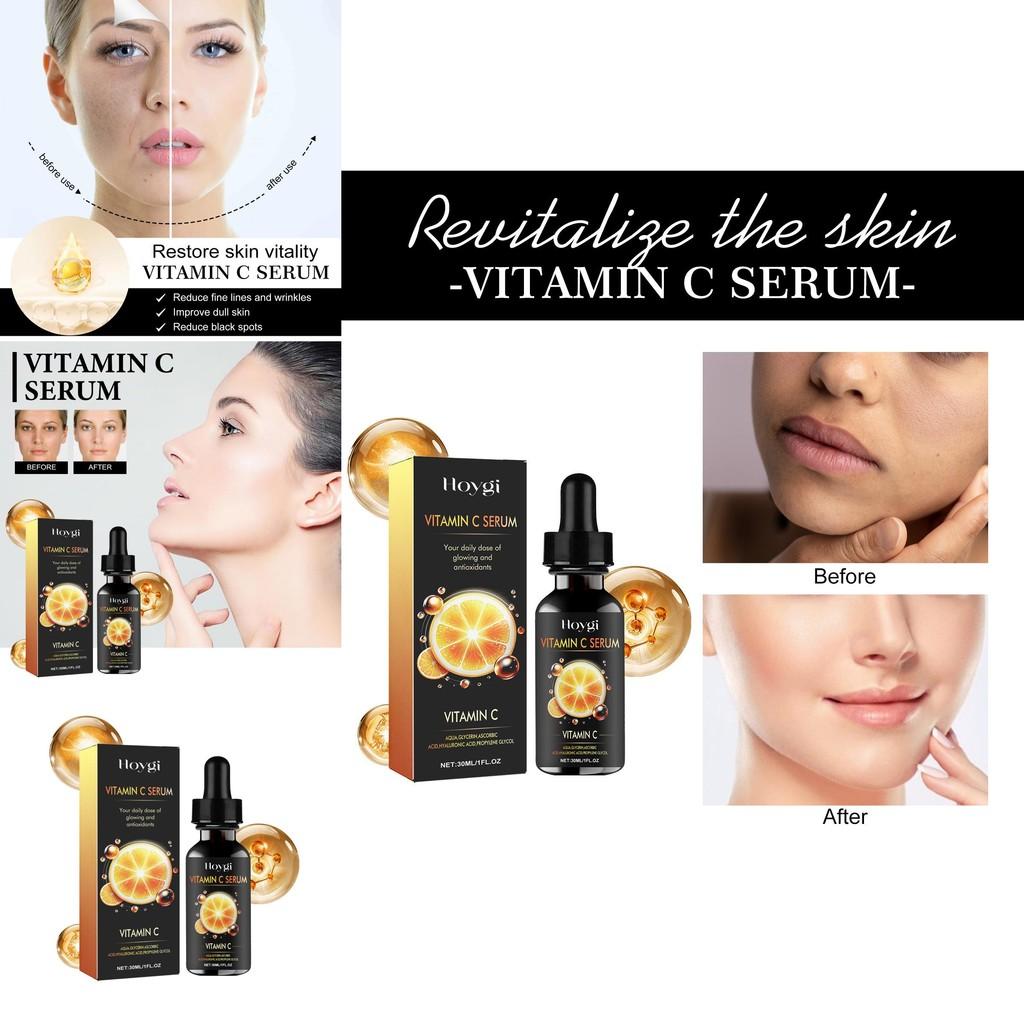 Hoygi Vitamin C Serum For Deep Hydration Brightening And Firming Skin Care 30ml
