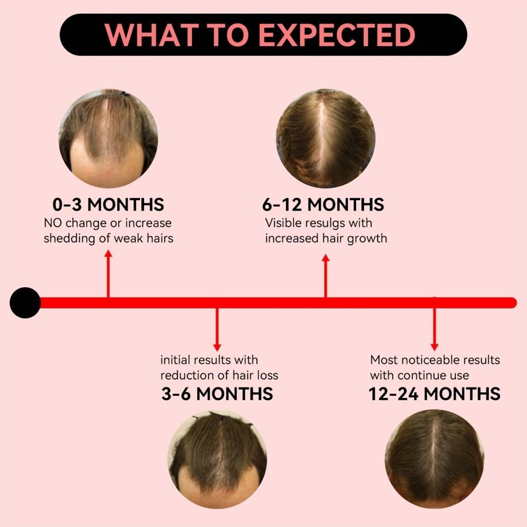 Hair Growth Cap Red Light Treatment Cap Infrared Hair Growth Cap Laser Hair Care Device To Prevent Hair Loss and Solve Hair Loss Problems