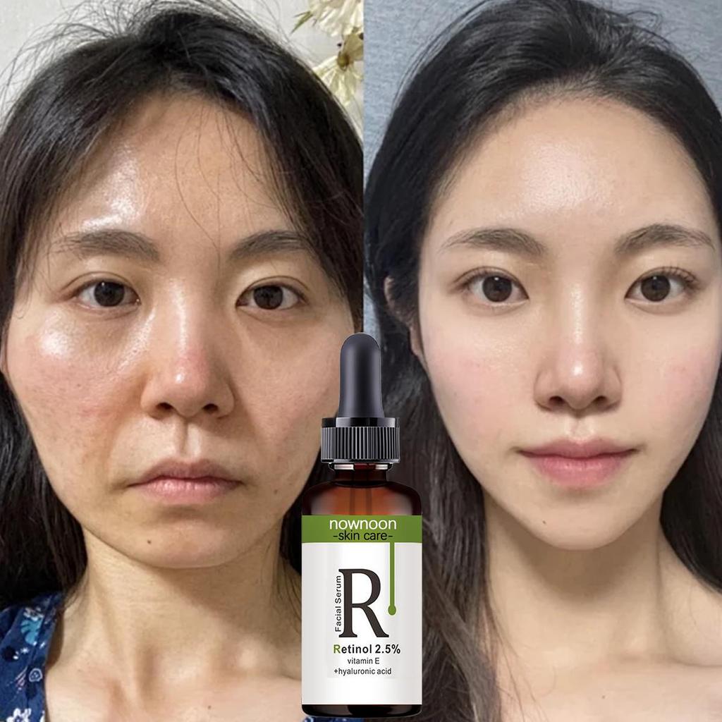 Retinol Firming Essence, Firming and Lifting Essence, Softening Skin, Improving Elasticity, Smoothing Wrinkles, Female Skin Care Essential Oil