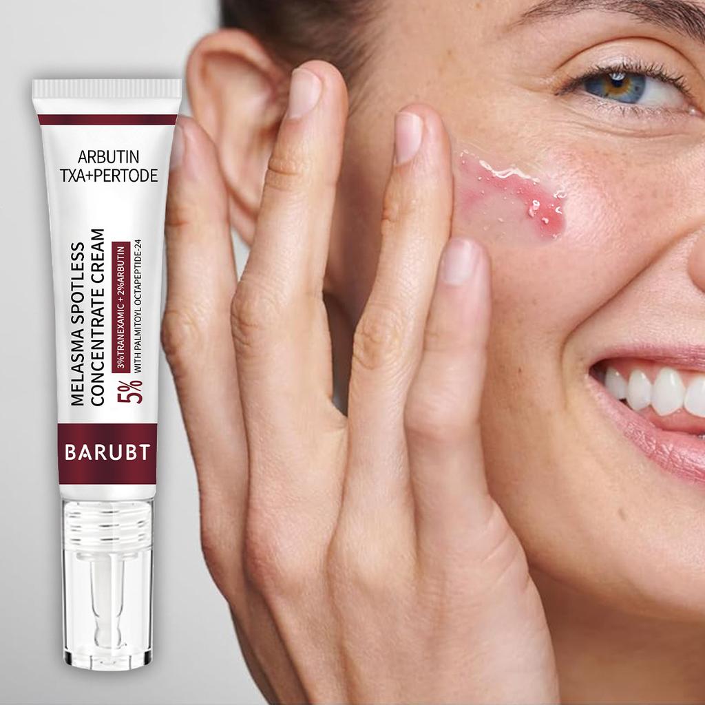 Bělící koncentrát na tmavé skvrny, hluboce rozpouštějící, přírodní extrakce, účinný krém na odstranění pigmentu, krása