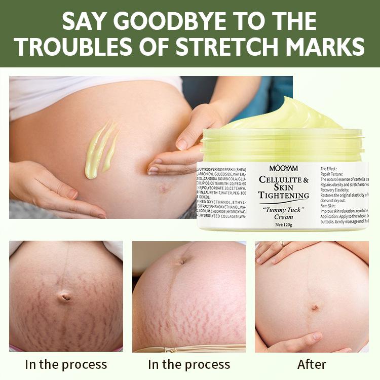 Natural Organic Anti Scar Skin Care Repair Treatment Cream Wrinkle Repair Moisturizing Cream