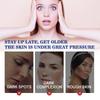 Niacinamide Brightening Blemish Fade Essence Whitening Skin Dark Spot Removal Hydrating Moisturizing Essence