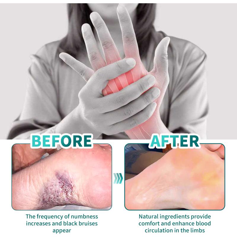 Relief Cream For Numbness In Hands And Feet Relieves Leg Swelling Repairs Wrist And Joint Pain Hand And Foot Care Cream