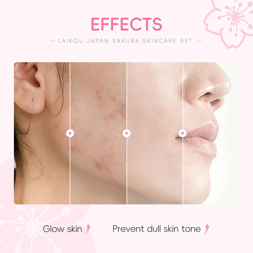 LAIKOU Sakura Kit Hautpflegesets Feuchtigkeitsspendend und Reduzierung feiner Linien Reinigung Poren Produkt 5-teiliges koreanisches Weihnachtsgeschenkset